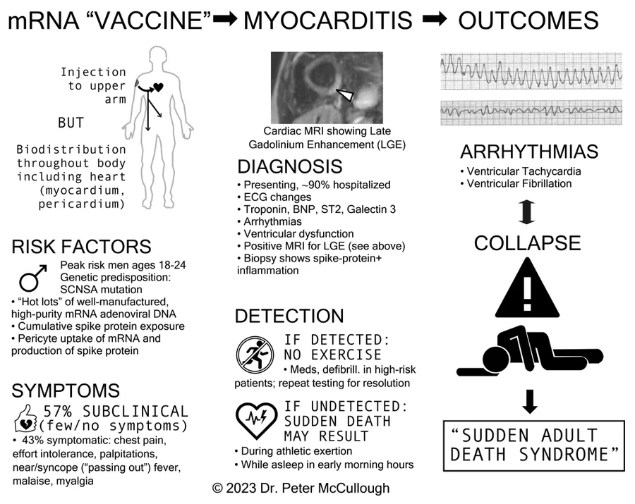 Myocardites et vaccins ARNm